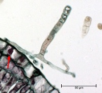 Figure 11.  Mycelium grows on the leaf surface but is able to penetrate the plant’s epidermal cells and form a balloon-shaped haustorium (arrow), which absorbs nutrients and anchors the fungus.  (Courtesy A. Baudoin from a Triarch Incorporated prepared slide).