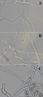 Figure 15. A) Sclerotinia homoeocarpa hyphae; note the presence of a septum. B) Pythium aphanidermatum hyphae with a noticeable lack of septa. C) Right- angled branching of Rhizoctonia solani hyphae; note the septum formed close to the branch origin (Courtesy T.W. Allen) 