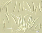 Figure 8. Macroconidia (top arrow), phialides (middle arrow), and sporodochium (bottom arrow) of Fusarium graminearum. (Used by permission of Keith Seifert, for the Department of Agriculture and Agri-Food, Government of Canada, © Minister of Public Works and Government Services Canada, 2003)