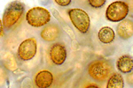 Figure 13. Diploid teliospores of Ustilago maydis are spherical to ellipsoid, olive-brown to black and heavily echinulated. (Courtesy K.M. Snetselaar)