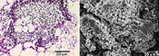 Figure 21. The section (on the left) and the scanning electron microscope image (on the right) give an indication of the large masses of fungal biomass that proliferate between the host cells as tumors enlarge. (Courtesy K.M. Snetselaar)