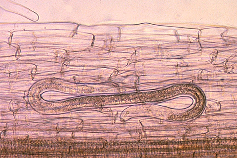 Lesion nematode inside root - medium magnification (Courtesy D. Wixted)