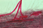 Figure 13. Lesion nematodes (stained red with acid fuchsin) penetrating a plant root. (Courtesy J. D. Eisenback, NemaPix)