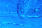 Figure 14. Stylet of a lesion nematode penetrating a plant cell for feeding. (Courtesy U. Zunke, NemaPix)