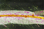 Figure 16. Many lesion nematodes (stained red with acid fuchsin) within a root. (Courtesy D. Rotenberg)