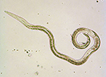 Figure 3. Pine wood nematode male showing diagnostic spicule (male copulatory organ). (Courtesy B. Moltsan, copyright-free) 