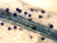 Figure 8. Aphanomyces euteiches oospores within pea root tissue. (University of Wisconsin-Madison Department of Plant Pathology 