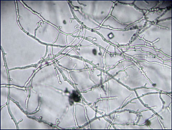 Figure 22. Typical hyphae of Phytophthora nicotianae. Note the absence of septations, irregular width, and presence of hyphal sw