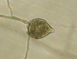 Figure 25. Ovoid Phytophthora nicotianae sporangium with conspicuous papillae.