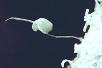 Figura 18. Zoósporo biflagelado (foto de microscopia eletrônica). (Cortesia M. Brown)