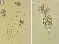 Figure 13. Sporangia and zoospores of Phytophthora capsici: (A) sporangia and zoospores in a culture plate; (B) a sporangium releasing zoospores. (Courtesy M. Babadoost)