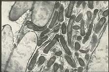 Figure 19a. Cells of Xylella fastidiosa within the xylem tissue of a pin oak petiole. (Courtesy J.R. Hartman) 
