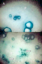 Tinción de Dienes de rábano picante infectado por Spiroplasma citri. Note la tinción del floema. (Cortesía de J. Fletcher)
