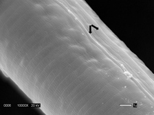 Scanning electron micrograph showing A. fragariae annulations and lateral field containing a narrow band with two incisures.