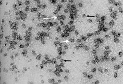 Electron micrograph of curly top virus geminate particles