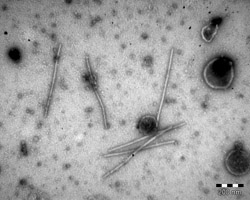 Electron micrograph of negatively stained Cowpea mild mottle virus particles in a leaf extract.