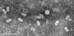 Electron micrograph of partially purified Bean golden mosaic virus particles.