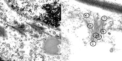 Transmission electron micrograph of CPMMV-infected bean leaf cell. 