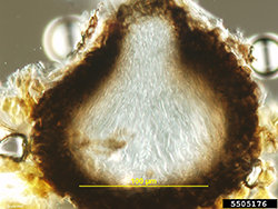 Figure 8. Cross section of a pseudothecium of Venturia inaequalis. The section has been stained so that the asci and ascospores 