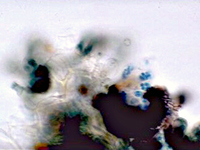 Figura 12. Pseudotécios esmagados de Mycosphaerella fijiensis. Os oito ascósporos de cada asco estão coloridos de azul. (Cortesia de A. Johanson)