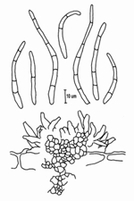 Figura 13. Esporodóquio e conídios de Pseudocercospora fijiensis. (De Ninoska, Pons. 1987. Notes on Mycosphaerella fijiensis var. difformis. Trans. Brit. Mycol. Soc. 89(1):120-124. Reproduzido com permissão da Cambridge University Press.)