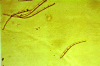 Figura 14. Conidias de Pseudocercospora fijiensis. (Cortesía de A. Johanson)