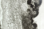 Figura 6. Masas de conidios en el néctar. Los conidios individuales no son visibles en esta imagen. (Cortesía de D. Mathre)
