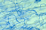 Figura 13. Micelio endófito (teñido de azul) en una hoja de gramínea. (Cortesía de R.L. Wick)