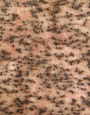 Figura 5. Peritécio de Gibberella zeae em meio cenoura-ágar. (Cortesia D. Schmale III)