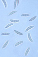 Figura 11. Ascósporos de Gibberella zeae são levemente curvados e com as extremidades arredondadas. (Courtesia R. Stack)