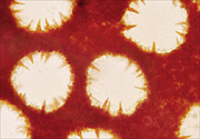 Figure 16. Short, reddish, pointed hymenial setae growing into pore lumens of Phellinus lamaensis. (400x) (Courtesy F. Brooks)