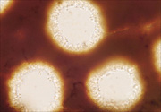 Figure 17. Phellinus noxius has no reddish hymenial setae growing into its pore lumens. (400x) (Courtesy F. Brooks) 