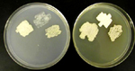 Figure 15. . Sporidial cultures can be propagated on many different media where they display considerable variation in morphology, color, size and growth. (Courtesy K.M. Snetselaar)