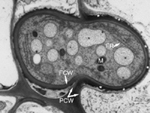 Figure 20. Electron microscopy of this section shows an electron-dense matrix material in between the plant cell wall (PCW) and fungal walls (FCW). This is a likely site of nutrient transfer, although few details are known. This material was prepared by freezing, and while the fungal cell is preserved very well, the plant cells are not. (Courtesy K.M. Snetselaar) 