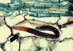 A burrowing nematode (Radopholus similis) feeds in the cortex of a ginger root. (Image by M. McClure, Univ. of Arizona, Bugwood.