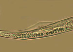 Figure 10. The spicule of the male burrowing nematode is enclosed in a bursa that does not extend to the tip of the tail. (Image