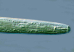 Figure 12. The female burrowing nematode has a strong stylet used for feeding. ( Image by R. Lopez-Chavez, Univ. Costa Rica, Bug