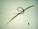 Figure 13. The male burrowing nematode is usually smaller than the female. (Image by K.-H. Wang, used with permission)