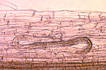 Figure 2. Lesion nematode inside root - medium magnification. (Courtesy D. Wixted)
