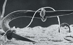 Figure 18. Scanning electron micrograph of a nematode-trapping fungus. (Courtesy H. H. Triantaphyllou)