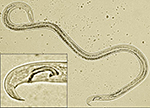 Figure 2. Pine wood nematodes - Bursaphelenchus xylophilus. (Courtesy P. Donald, copyright-free) 