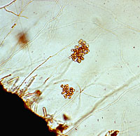 Figure 9. Sporangia and primary zoospores of Aphanomyces euteiches from alfalfa roots. (APS image; Image adjusted from original 