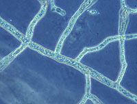 Figure 10. Coenocytic hyphae of Aphanomyces euteiches. (University of Wisconsin-Madison Department of Plant Pathology Image)