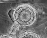 Figure 11. Oogonium, antheridium and oospore of Aphanomyces euteiches isolated from pea. (University of Wisconsin-Madison Depart