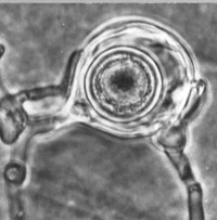 Figure 12. Oogonium, antheridium and oospore of Aphanomyces euteiches isolated from bean. Note the characteristically large aple
