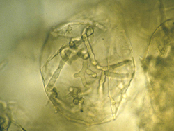 Figure 6. Hyphae of Phytophthora nicotianae in a parenchyma cell from the pith of an infected tobacco plant. Note the irregular 
