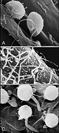 Figure 27. Phytophthora nicotianae zoospores attach to a host root, encyst, and directly penetrate the host epidermis. A. Motile