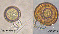 Figure 29. Sexual Phytophthora nicotianae oospores. The antheridium is amphigynous and remains permanently attached. The oospore
