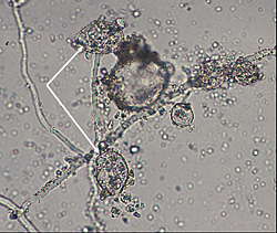 Figure 31. Phytophthora nicotianae chlamydospore (center) germinating to produce sporangia (arrows).