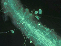 Figure 34. Sporangia of Phytophthora nicotianae on root surface.